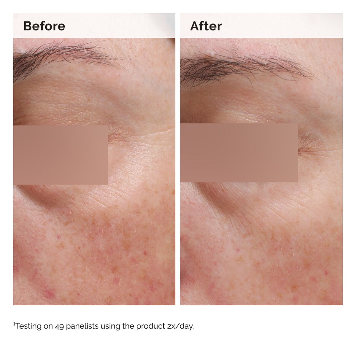 niacinamide-5-face-and-body-emulsion-s0 2024-08-23-ORD-Nia-5pct-Face-Body-B-A-Elasticity-Global-02-1x1.jpg