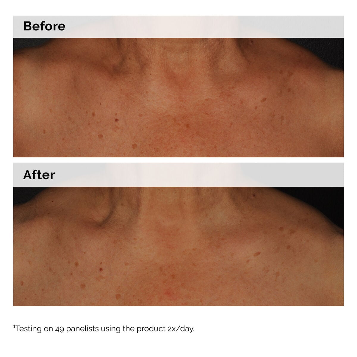 niacinamide-5-face-and-body-emulsion-s0 2024-08-23-ORD-Nia-5pct-Face-Body-B-A-Global-02-1x1.jpg