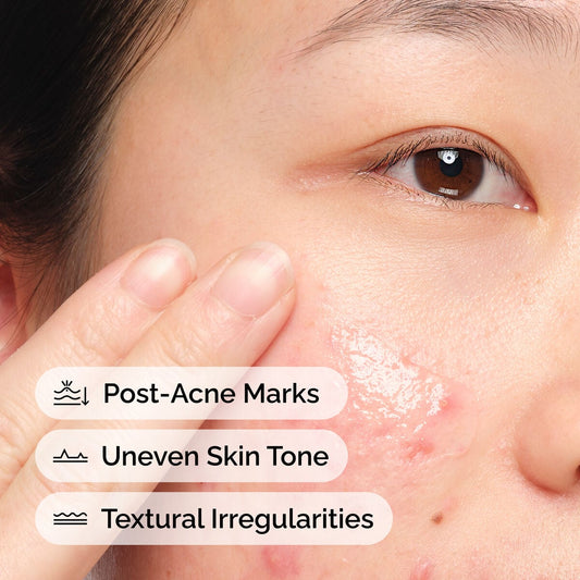 aloe-2-nag-2-solution-m5 FY25-D41247-ORD-Web-PDP-Aloe-Nag-1x1-EN-4d.jpg