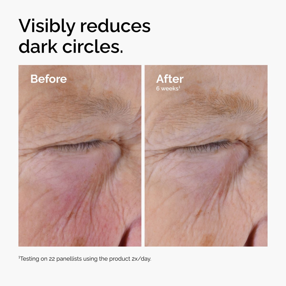 caffeine-solution-5-egcg-eye-serum-q1 ord-caffeine-solution-egcg-dark-circles-before-after.jpg