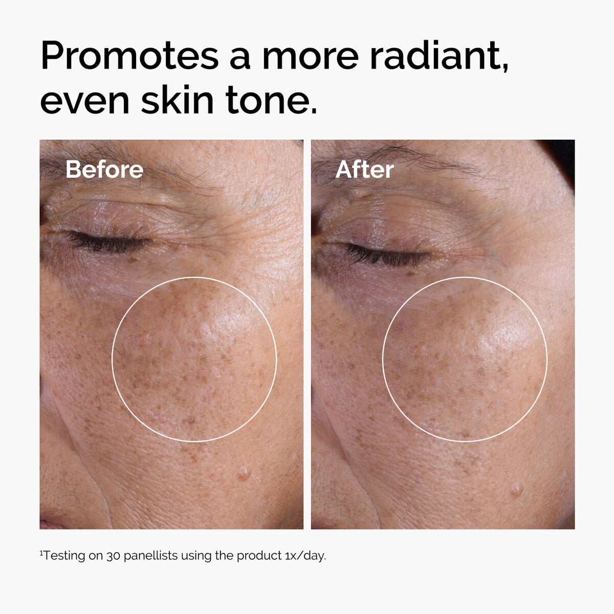 glycolic-acid-7-exfoliating-toner-f2 ord-glycolic-before-after-radiance.jpg