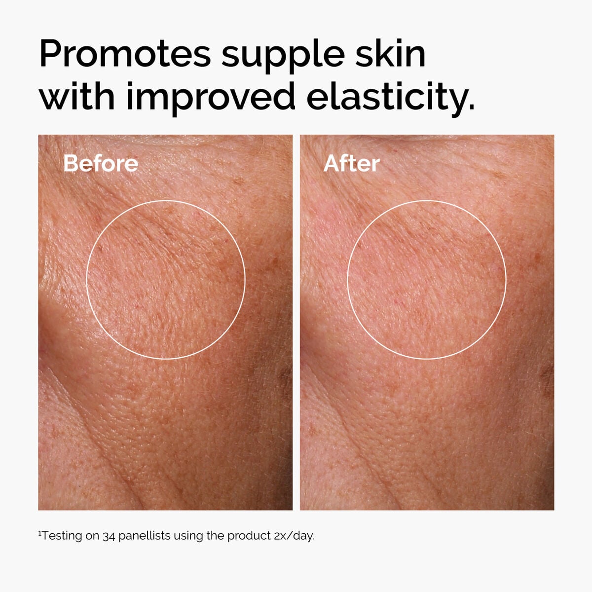 hyaluronic-acid-2-b5-with-ceramides-n5 ord-hyaluronic-acid-2pct-b5-hydrating-serum-before-after-elasticity.jpg