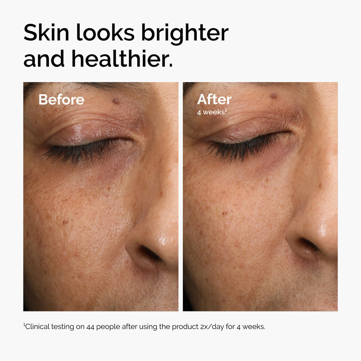 multi-antioxidant-radiance-serum-z4 ord-mars-before-after-healthy.jpg