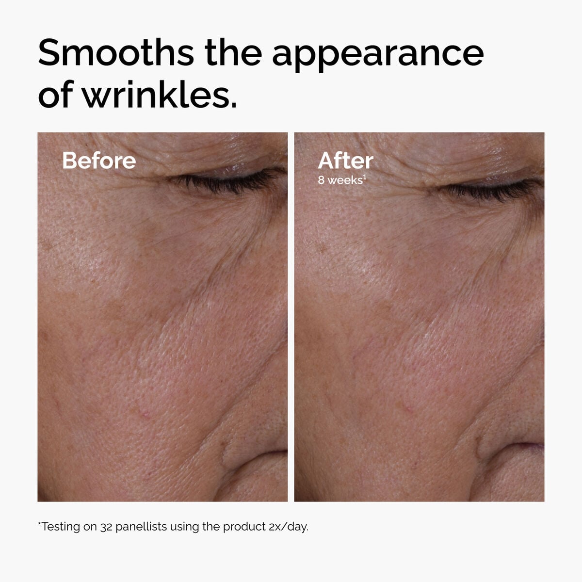 multi-peptide-ha-serum-u6 ord-multi-peptide-ha-serum-wrinkles-before-after.jpg