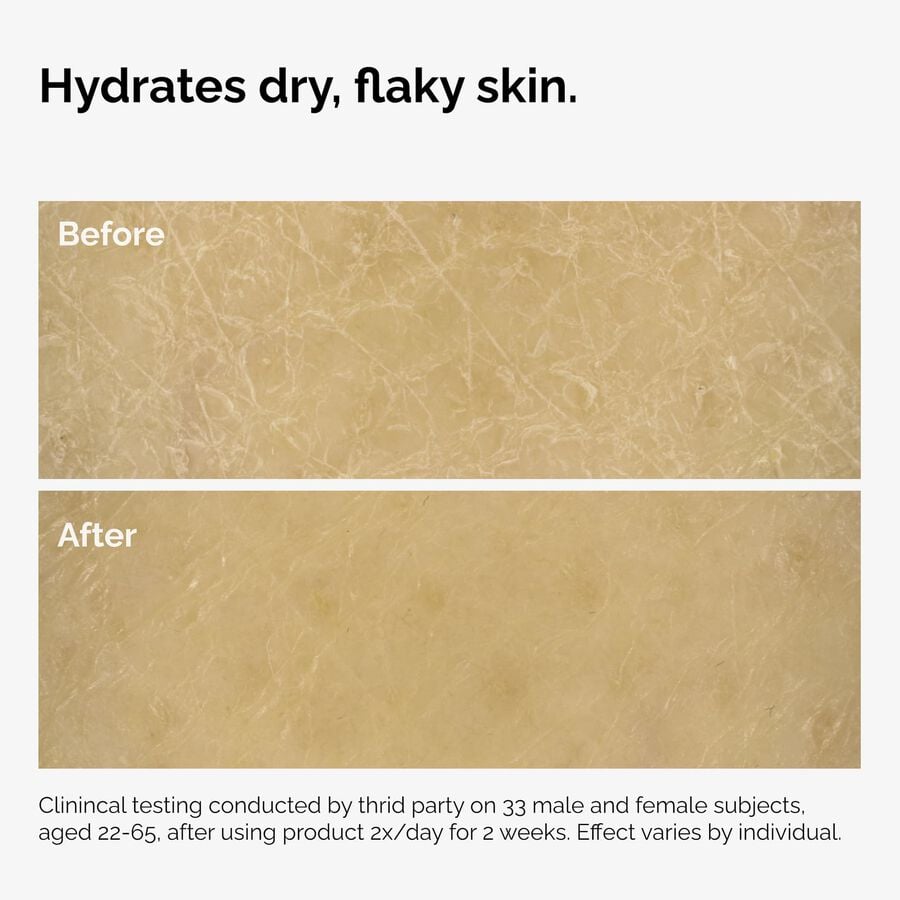 the-body-care-collection-p8 ord-natural-moisturizing-factors-inulin-body-before-after-graphic-02.jpg