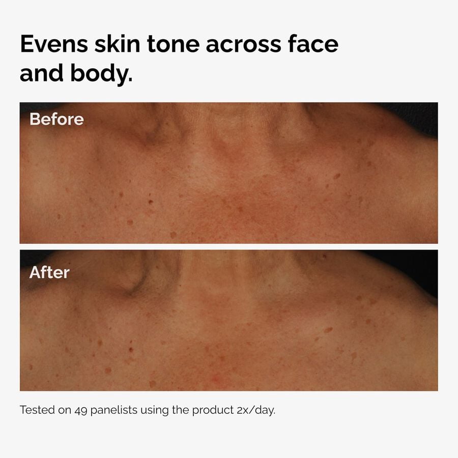 the-body-care-collection-p8 ord-niacinamide-face-body-serum-before-after-even-tone-graphic.jpg