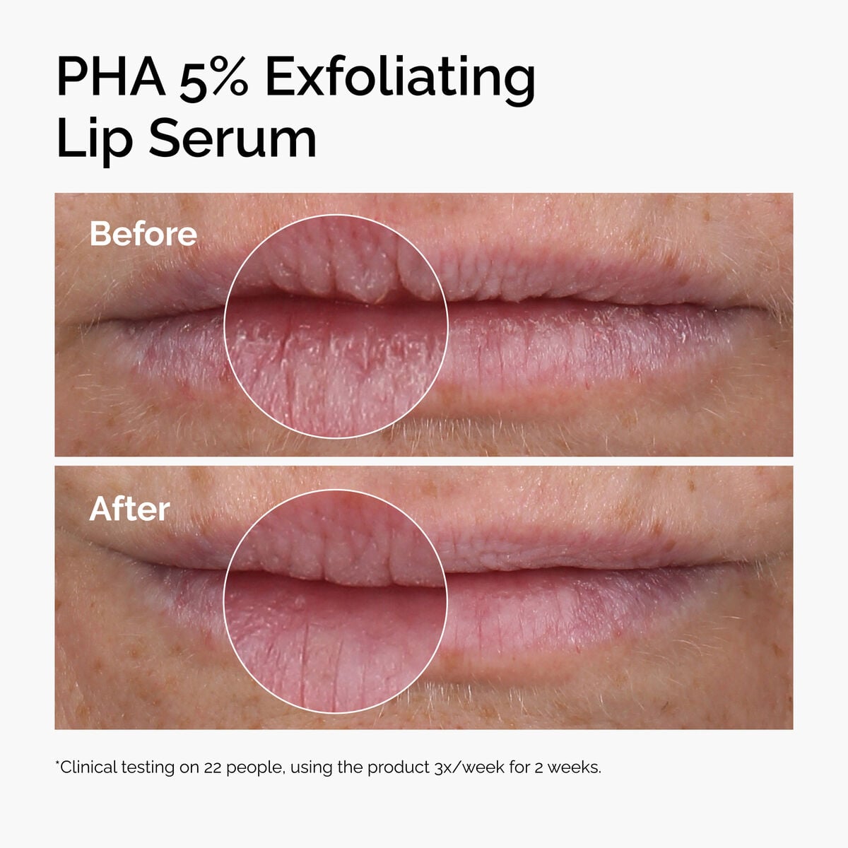 pha-5-exfoliating-lip-serum-s2 ord-pha-5pct-lip-exfoliating-serum-before-after.jpg