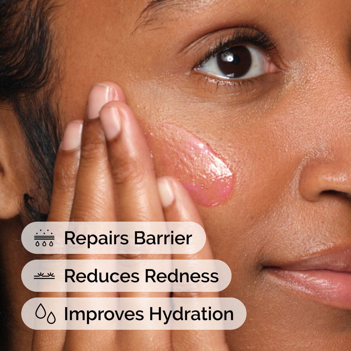soothing-and-barrier-support-serum-set-u9 ord-soothing-barrier-support-serum-model-application-with-benefits.jpg