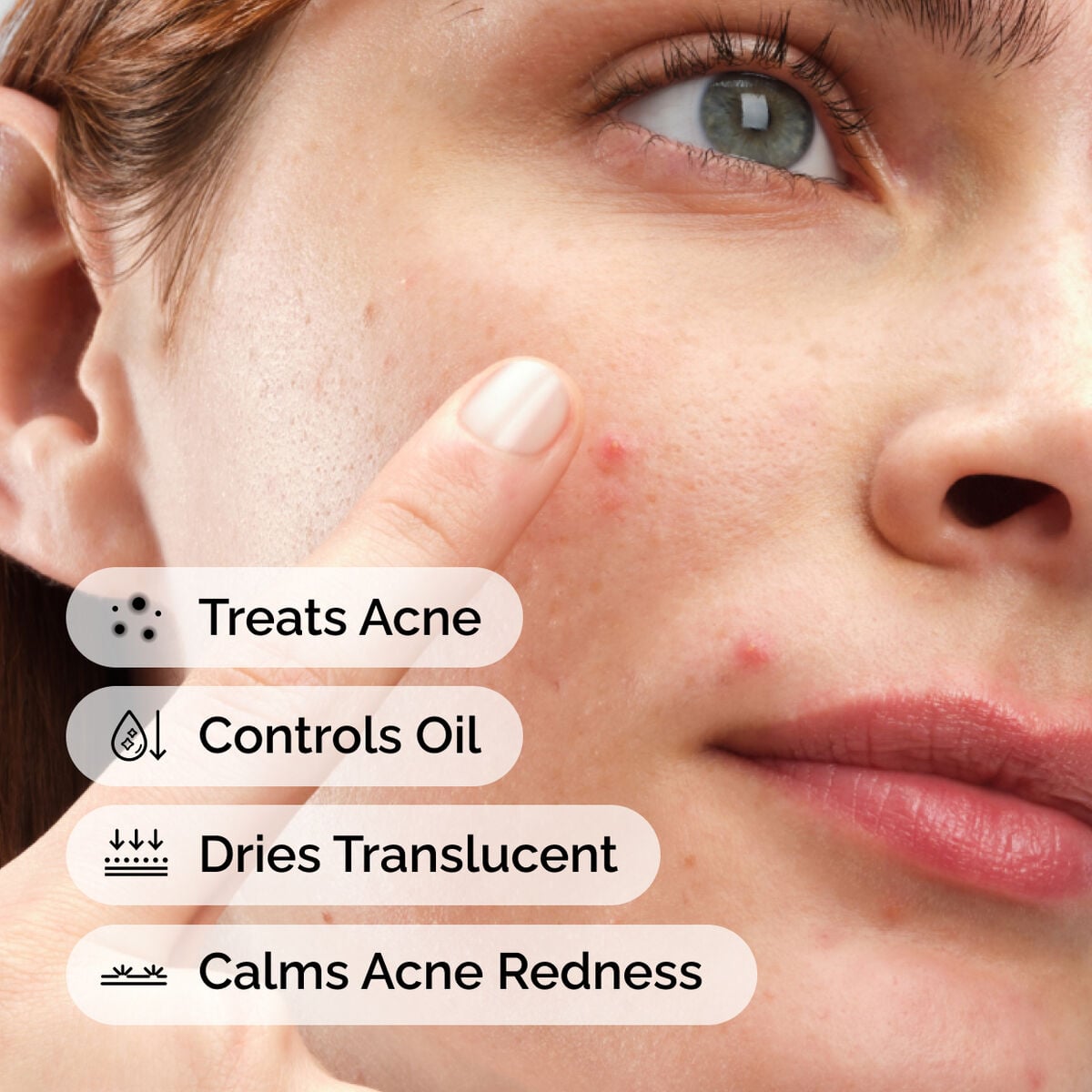 sulfur-10-powder-to-cream-concentrate-o7 ord-sulfur-10pct-powder-to-cream-concentrate-model-application-with-benefits-acne.jpg